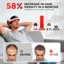 Red Light Therapy for Hair Growth Laser Cap - FDA Cleared Laser Therapy Device - Promotes Hair Regrowth Alopecia Treatment for Men & Women