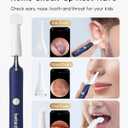 Bebird Earsight Plus R37R Ear Cleaning Camera Wax Removal Tool kit, FSA HSA Eligible Flexible Ear Scope Otoscope Camera Light, Visual Ear Picker Wireless Earwax Remover Tweezers for Adults & Kids (Blue)