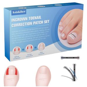 Titanium Alloy Ingrown Toenail Treatment, Ingrown Toenail Removal Kit for Curved Nail Repair, Ingrown Nail Tool for Home Use