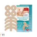 Silicone Scar Sheets, Silicone Scar Tape, 555