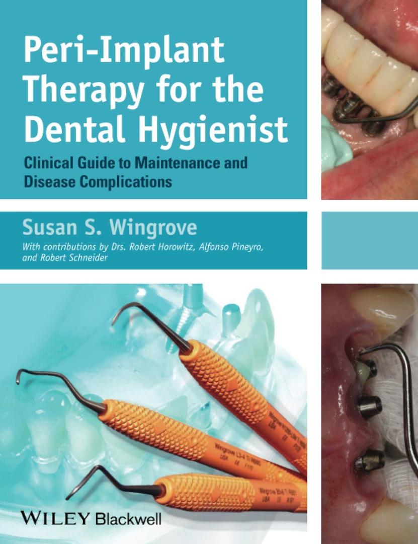 Peri-Implant Therapy for the Dental Hygienist: Clinical Guide to Maintenance and Disease Complications