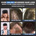 Laser Cap, FDA Cleared Laser Hair Growth Cap, Red Light Therapy promote hair growth in women and men