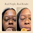 Glo Melanin Dark Spot Remover for Face - Dark Spot Corrector Serum with Vitamin C - Reduces Discoloration and Hyperpigmentation
