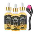 Ginger Oil for Hair Growth - Biotin Hair Growth Serum, 100% Pure Natural Ginger Essential Oil - Promotes Stronger, Thicker, Longer Hair in Women & Men (3pc+roller)