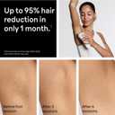 Braun IPL, SilkExpert Pro 5, IPL Hair Removal for Women and Men, Permanent Laser Hair Reduction At-Home, 2 Heads, Pouch, Venus Razor, IPL5157