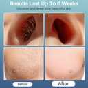 BLITZWAX Back and Nose Waxing Kit for Men, Hard Wax Warmer for Brazilian, Body and Face, At Home Hair Removal Kit, Beginner Friendly, Quick Heating, 93 Accessories, Blue Waves