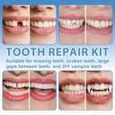 XLMCWT Tooth Repair Kit, Moldable False Teeth Beads for Teeth Repair, Suitable for Missing, Cracked DIY Denture Kit, 1PCS