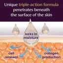 Mederma Advanced Scar Gel - Treats Old & New Scars, Reduces Appearance of Scars from Acne, Surgery, Burns, Injury & Stretch Marks, 0.70 Oz (20g)