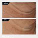 Revision Skincare Nectifirm Advanced Neck Cream Clinically Proven to Firm, Lift & Contour the Neck, Jawline & Dcolletage, Correcting Visible Signs of Aging and Weight Loss