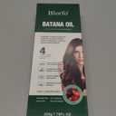 Batana Oil for Hair Growth – 100% Pure Organic & Raw Batana – Promotes Thicker, Stronger Hair, Helps Prevent Hair Loss – Natural for Men & Women – 10.58 oz By 2028/05/09