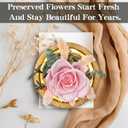 Preserved Roses & Fresh Flowers Bouquet Gift for Women, Roses that Last Forever, Flowers for Delivery Prime Birthday, Mothers Day & Christmas