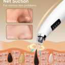 Pore Vacuum Blackhead Remover - Pore Extractor with 5 Attachments & 3 Suction Levels - Blackhead Remover Tools for Women and Men (White)