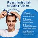 6 Pack 5% Minoxidil with Biotin, Hair Growth Treatment, Minoxidil Hair and Beard Growth Serum, Minoxidil for Men and Women, Supports Thicker and Fuller Hair & Beard (12 fl oz, 6 Month Supply)