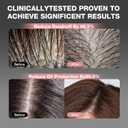 Hair Growth Shampoo and Conditioner Routine Set for Anti-Thinning Hair, Stronger, Thicker and Longer Hair, Growth with Paraben Free Women & Men Color-Safe for Hair Loss & Hair Wellness