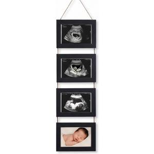 4-in-1 Sonogram Picture Frame, Display Pregnancy Keepsake Album for Pregnancy Announcements, Gender Reveal, and Newborn Photos, Perfect Gender-Neutral Nursery Decor, First Time Mom Gift, Black