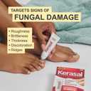 Kerasal Nail Fungus Extra Strength | Restorative