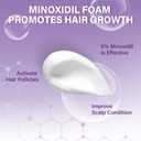 5% Minoxidil Foam for Women