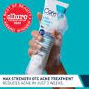 CeraVe Acne Foaming Cream Wash, Gentle Face and Body Cleanser with Benzoyl Peroxide 10%, Hyaluronic Acid, and Niacinamide, 10% Benzoyl Peroxide Treatment Clears Pimples and Blackheads, 5 Oz