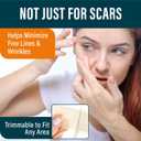 NUVADERMIS Silicone Scar Sheets - Extra Long Scar Sheets for C-Section, Tummy Tuck, Keloid, and Surgical Scars - Reusable Medical Grade Silicone Scar Sheets - Pack of 4 - Light Tone