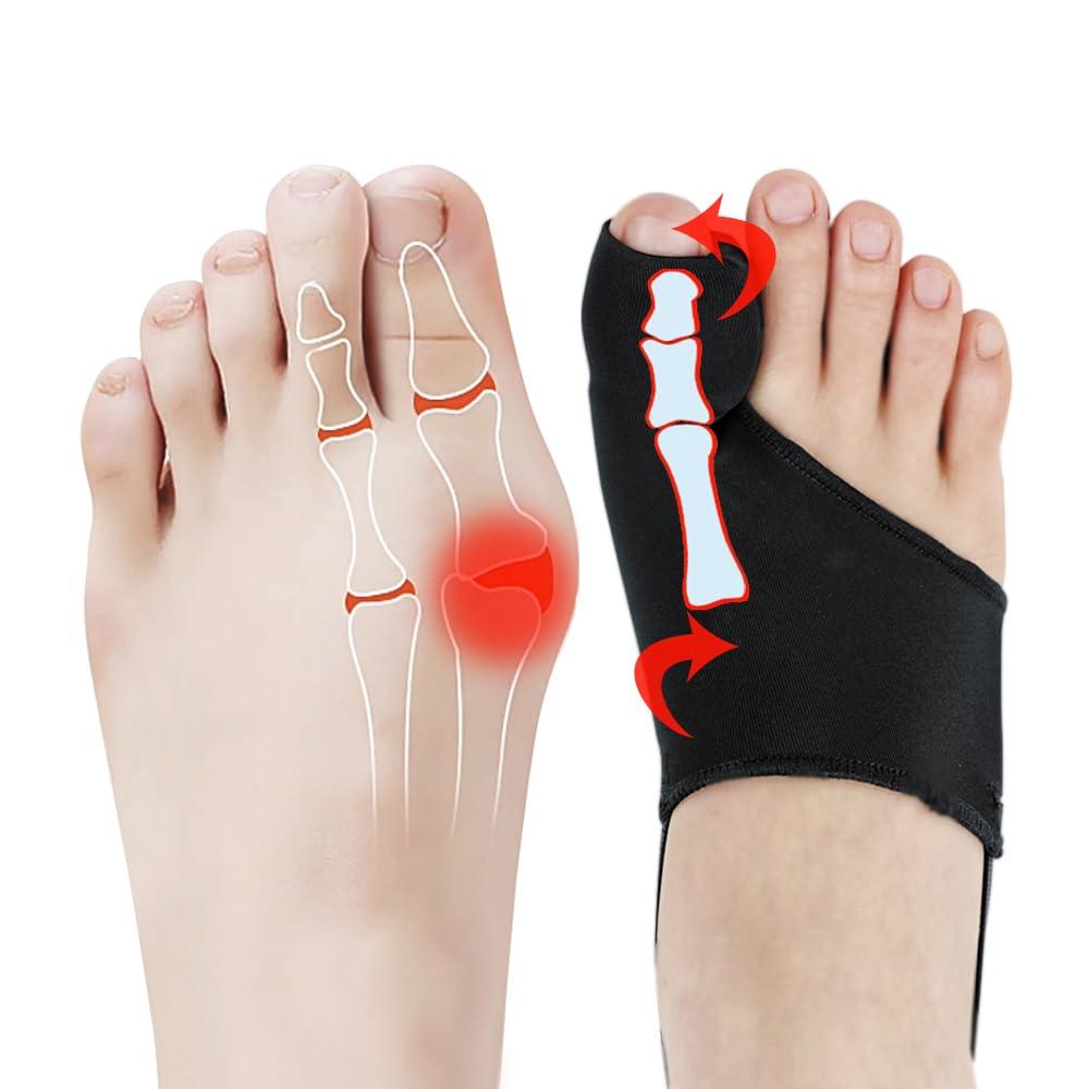 Bunion Corrector for Women & Men - Adjustable Hallux Valgus Brace, Day & Night Bunion Pain Relief Fix Socks, Comfortable Breathable Toe Splint Kit for Bunions