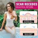 Silicone Scar Sheets, 8 Pcs Medical Grade & Reusable Breast Silicone Scar Tape for Surgical Scars (8 Count (Pack of 1))