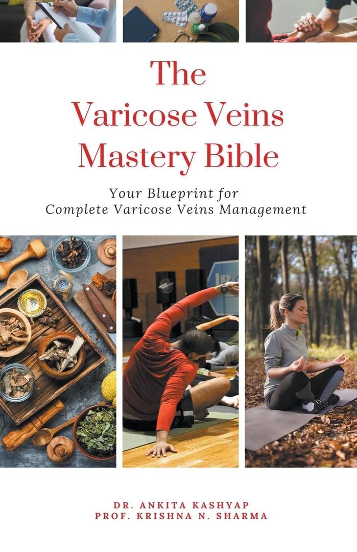 The Varicose Veins Mastery Bible: Your Blueprint for Complete Varicose Veins Management, Paperback