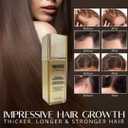 Scalp Serum Clinically Tested Non-Greasy Formula with Amino Acids, Biotin & Rosemary Oil Promotes Healthy Scalp & Fuller-Looking Hair, Reduces Oil & Product Buildup Hair Growth Serum