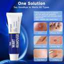 10 x Fast Acting Wart Remover, with Salicylic Acid for Women and Men, Corns, Flat, Common and Plantar Warts 20g