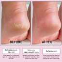 grace & stella Award-Winning Foot Peel Mask (4 Pairs, Unscented) | Foot Peeling Mask with Aloe Vera - Moisturizing Foot Mask for Dry Cracked Feet - Foot Exfoliator for Baby Soft Feet