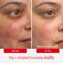 First Aid Beauty Ultra Repair Cream, Intense Hydration Face & Body Moisturizer with Colloidal Oatmeal, Helps Relieve Eczema, Dry Skin Barrier Repair, Fragrance Free