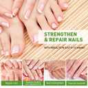 Ginger Nail Treatment, Ginger Cuticle Care Oil for Nails, Strengthen Nails, Ginger Nail Treatment Serum, Promote Nail Growth, Natural Plant Formula 30ml