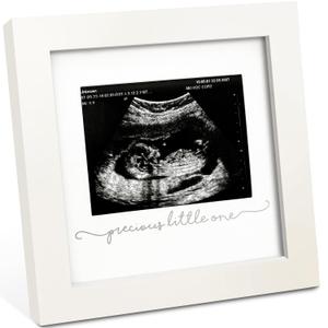 KeaBabies Baby Sonogram Picture Frame - Modern Ultrasound Picture Frames for Mom to Be, First Pregnancy Gifts for Expecting Mom, Baby Gender Reveal Gifts, First Mother's Day (Alpine White) (Solo Sonogram)