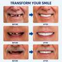 2 x DIY Denture Kit for Home Use – Upper & Lower Fake Teeth Set, Natural Smile Replacement, Comfortable Fit, Emergency Tooth Solution, 1-Pack