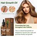 Organic Batana Oil with Rosemary for Hair Growth - Deep Nourishes All Hair Types, Reduces Hair Loss, 30ml