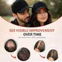 LLLT Laser Hair Growth Cap, 650nm Red Light Therapy Cap, Black