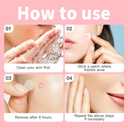 4 x Acne Patches for Face, 36 Count Clear Pimple Stickers, Blemish Cover for Acne