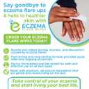 Eczema Flare Wipes - All-Natural Fast Acting Eczema Relief, Anti-Itch, Reduces Inflammation & Protects Skin Barrier, Soothes & Prevents Future Flares, pH-Balancing, Convenient On-The-Go Solution 72ct