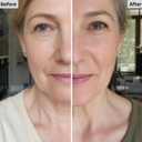 VitailQ Anti Wrinkle Calcium Balm, Hydrating Face Moisturizer for Eyes,Neck, Face