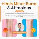 Ion Spray for Burns - Fast-Acting Topical Support for Skin, Scar Prevention - Mild & Severe Sunburn Care - Natural & Safe - 60ml