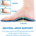 Orthotics Arch Support Metatarsalgia Insoles - Mortons Neuroma Inserts Relief Ball of Foot Pain - Orthopedic Insoles for Flat Feet - Shoe Inserts for Plantar Fasciitis (Red L)