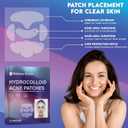 Hydrocolloid Full Face Acne Patches  10 PCS Large Zit Stickers for Chin, Nose, Forehead & Cheeks  Oil Absorbing Hydrocolloid Pimple Patches for All Skin Types  Gentle, Invisible