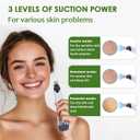Blackhead Remover Pore Vacuum, Pimple Extractor with 4 Probes and 3 Suction Levels, Electric Facial Cleanser with Extra 4 Pcs Blemish Tool Kit, USB Rechargeable, (White)