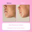 Hair Remover Cream for Face, 15 Minutes - Facial Hair Removal for Women, Hair Removal Trilogy Kit for Coarse, Fine and Stubborn Hairs, Removes Hair from Chin, Upper Lip & Sideburns (1 Set)
