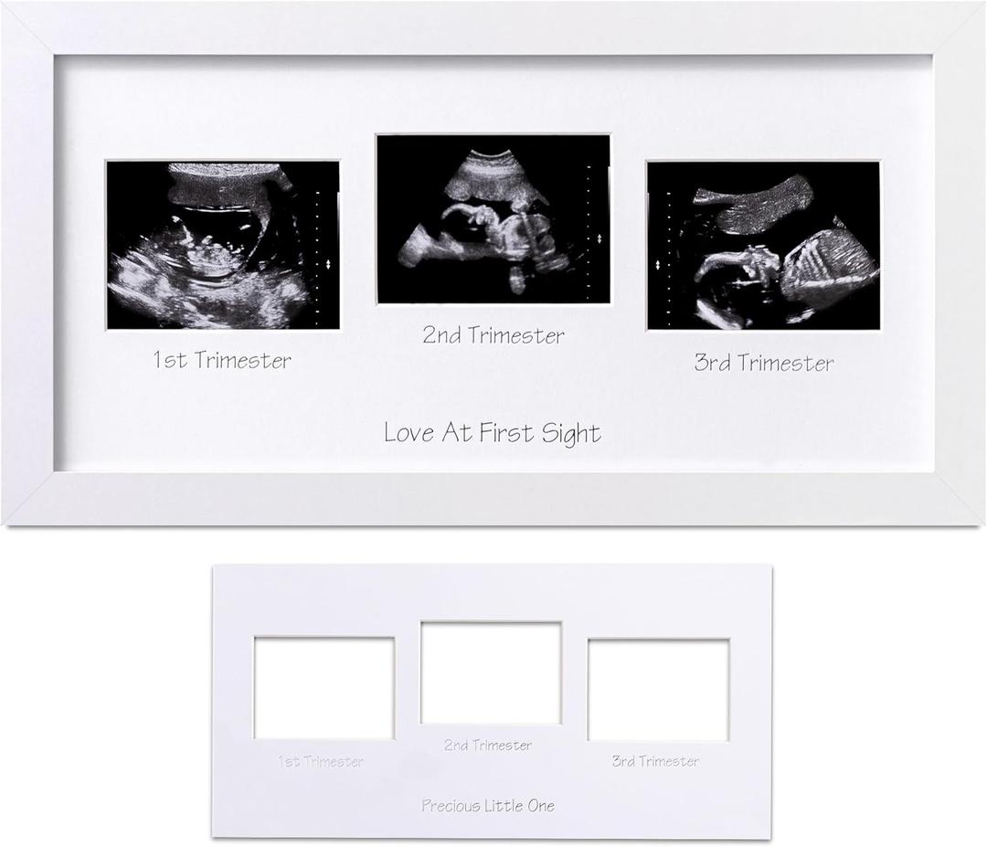 eletecpro Triple Ultrasound Picture Frame, Display 34 Sonogram Photo, Keepsake Frame for Pregnancy Announcements, Expecting Parents, Baby Shower, Gender Reveal Party, Baby Nursery Decor, White (15x8)
