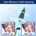 Plaque Remover for Teeth, Pet Ultrasonic Cleaner, Dog Plaque and Tartar Remover with LED Light, Dog Teeth Cleaning Dental Care Kit for Tartar and Stains, Suitable for Dogs and Cats (Black)