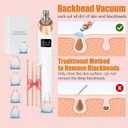 2026 Pore Vacuum, USB Rechargeable Blackhead Remover Vacuum,3 Levels Adjustable Pore Vacuum Blackhead Remover, with 5 Suction Power,6 Probes,Face Vacuum Pore Cleanser for Women & Men-White