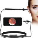 3.9mm Ultra-Thin Portable USB Digital Otoscope Camera with Carrying Case, HD 720P 6 LED Visual Ear Scope with 3 Hats 2 Silicone Caps 8 Earwax Spoons for Android Windows Mac NOT for iPhone iPad