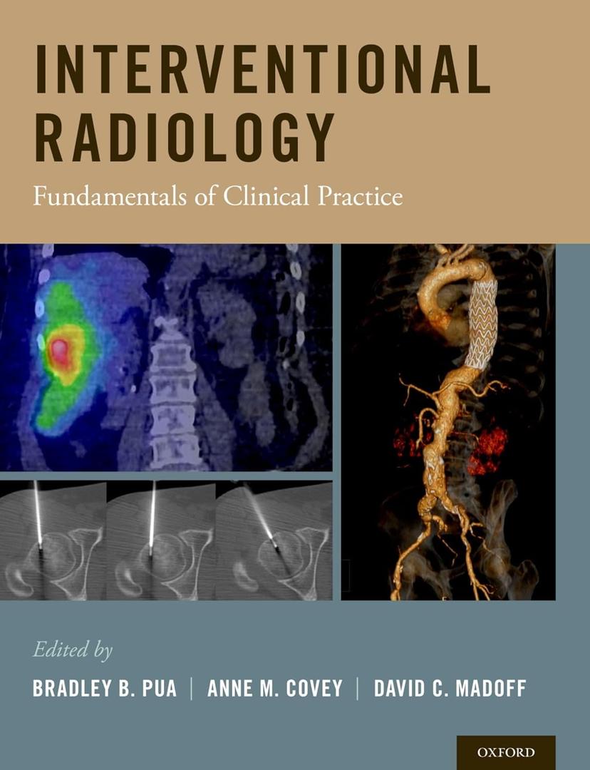 Interventional Radiology: Fundamentals of Clinical Practice Hardcover