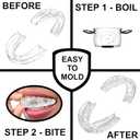 2 x Anti Grinding Guard - Mouth Guard for Women  2 Sizes, Custom Fit, Non-Bulky, Moldable, Trimmable  (4) Mouth Guards for Teeth Grinding & Case  Comfortable Mouthguard, Night Guard for Tooth Grinding