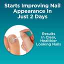 2 x Opti-Nail 2-in-1 Toe Nail Fungus Treatments Plus Antifungal, Improves Nail Appearance and Kills Fungus